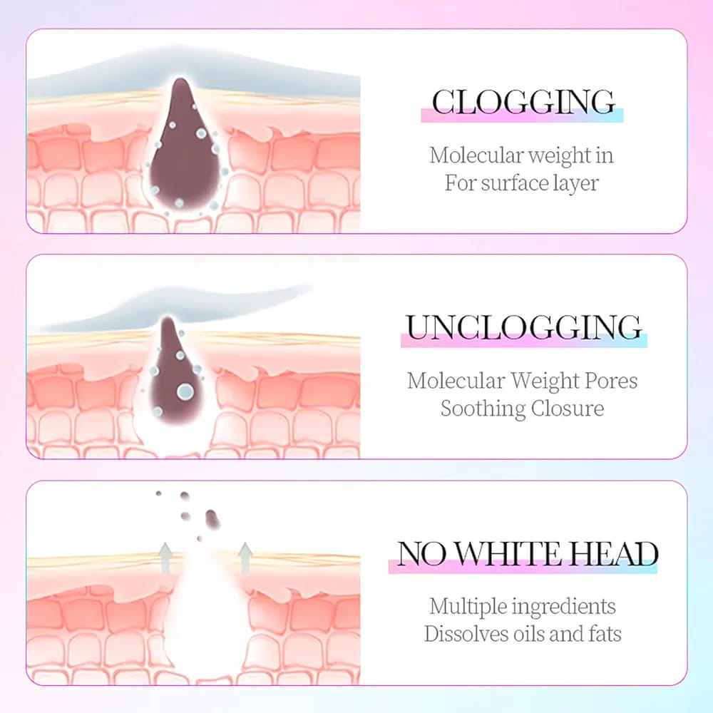 3 Step Blackhead Remover